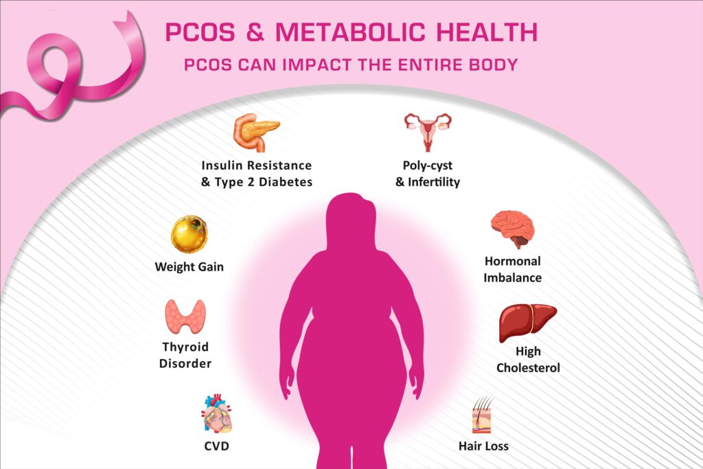 PCOS and metabolic health